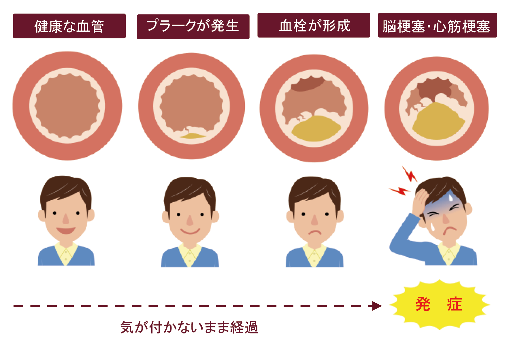 LOX-index血管内